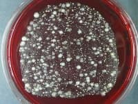 Sample 1 – Petri dish