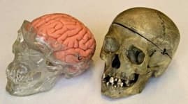 Sample 6 – Skull