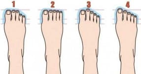 Sample 4 – Foot
