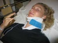 Sample 6 – Neck brace